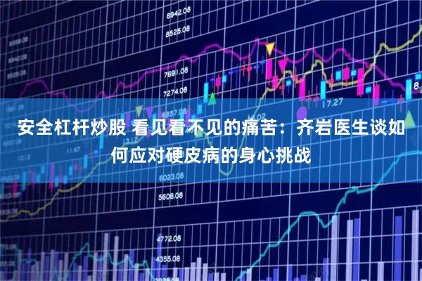安全杠杆炒股 看见看不见的痛苦：齐岩医生谈如何应对硬皮病的身心挑战